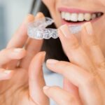 Unlocking the Secret to Radiant Smiles Inlays & Onlays in Rochdale