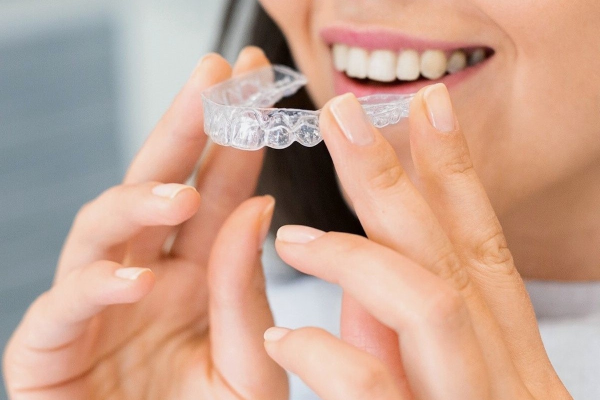 Unlocking the Secret to Radiant Smiles Inlays & Onlays in Rochdale